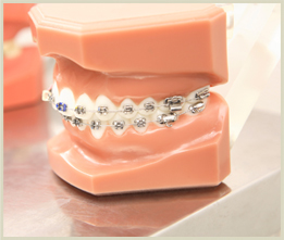 矯正歯科治療の仕組み